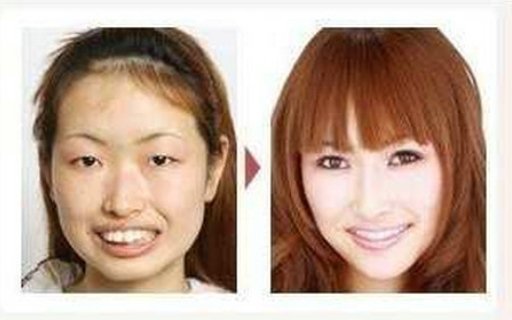 女子迷上整容,月挥霍50万!丈夫提出离婚,要求还一半金额,女子会还吗?