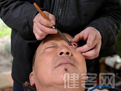 刀锋洗眼的技艺介绍