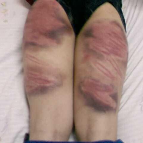 塔沟武校学生打架后教练会怎么处理