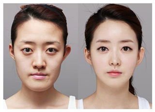 女子迷上整容,月挥霍50万!丈夫提出离婚,要求还一半金额,女子会还吗?