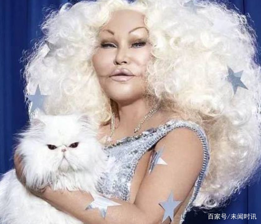 为了丈夫整容成猫女的富婆，获25亿分手费，后来怎样了？