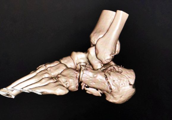 瓦解的意思是什么