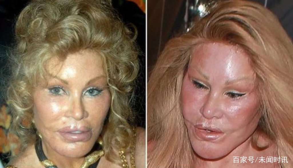 为了丈夫整容成猫女的富婆,获25亿分手费,后来怎样了?