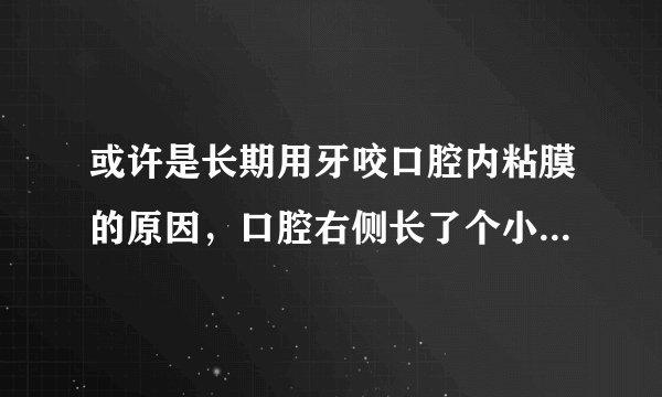 或许是长期用牙咬口腔内粘膜的原因，口腔右侧长了个小疙瘩，绿豆大小，不疼不痒，但是很担心，什么原因呢