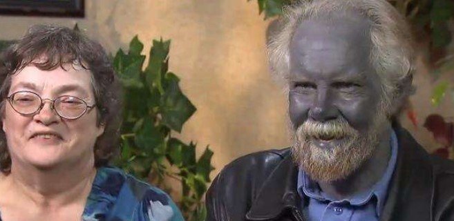 除了白种人、黑人、黄种人外，世界上存在像电影《阿凡达》里面的蓝种人吗？