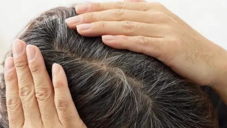 男子回应“不用洗发水变满头黑发”：那只是第一步，想要长头发要注意什么？