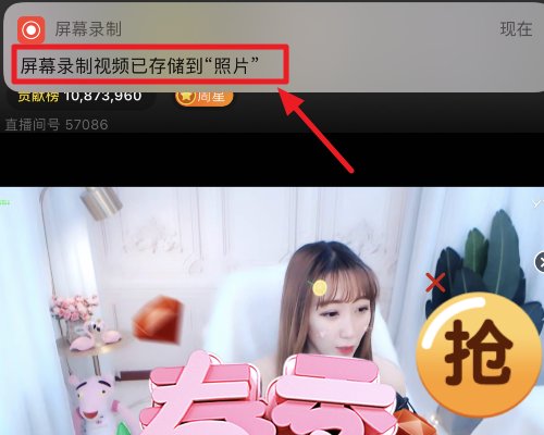 手机看yy直播时怎么保存视频到手机上要下载什么软件吗？
