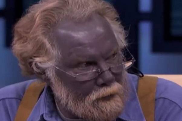 除了白种人、黑人、黄种人外，世界上存在像电影《阿凡达》里面的蓝种人吗？