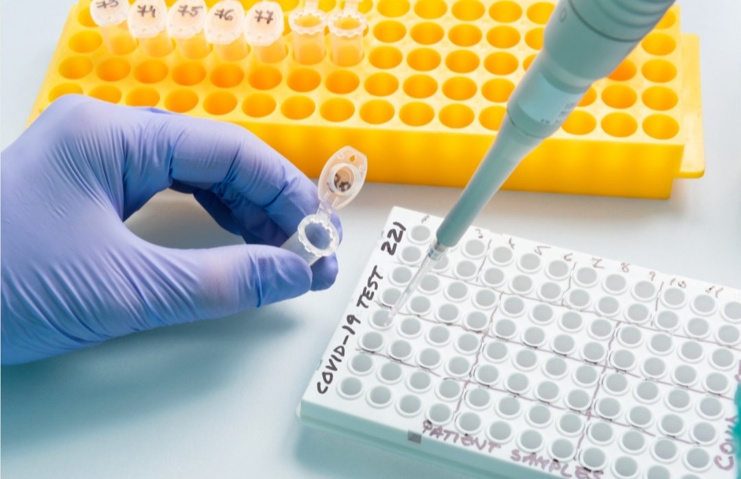 核酸试剂企业毛利堪比茅台，利润丰厚，核酸试剂企业目前是什么发展水平？