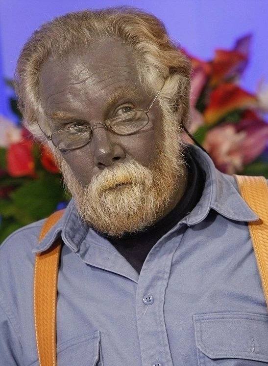 除了白种人、黑人、黄种人外，世界上存在像电影《阿凡达》里面的蓝种人吗？