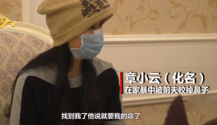 谁给我说说女子拒绝复婚被前夫咬掉鼻子的具体情况？