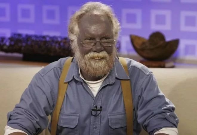 除了白种人、黑人、黄种人外，世界上存在像电影《阿凡达》里面的蓝种人吗？