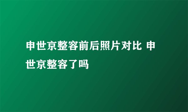 申世京整容前后照片对比 申世京整容了吗