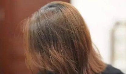 男子回应“不用洗发水变满头黑发”：那只是第一步，想要长头发要注意什么？