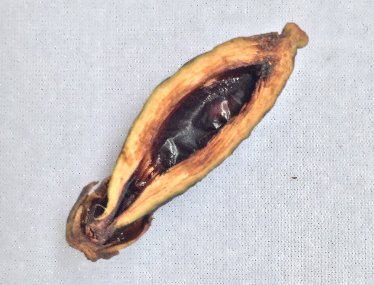 多地要求下架槟榔，海南槟榔协会回应，槟榔为什么致癌？