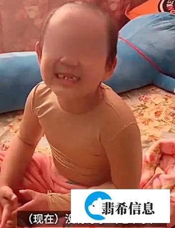 堪比“日寇暴行“，抚顺6岁被虐女童，到底有多惨！
