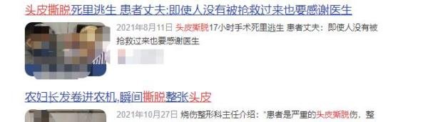 瞬间被整个撕脱!女子在游乐场发生意外