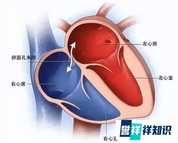 徐州一女子偏头痛多年，竟因“多心眼儿”