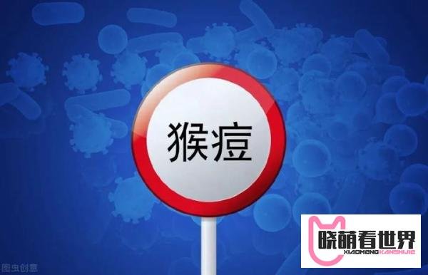 11国80例猴痘病例！猴痘概念股票有哪些？