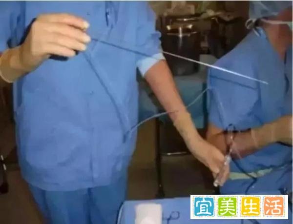 18岁少女多次捐卵生命垂危：我，亲手给自己判了死刑