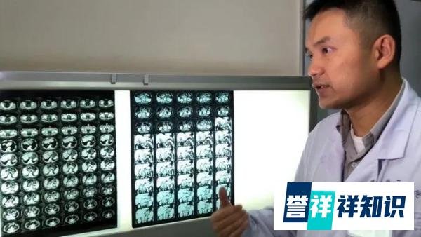 屠夫医生刘翔峰，逼迫病人天价化疗，表面救死扶伤，背地摘人器官