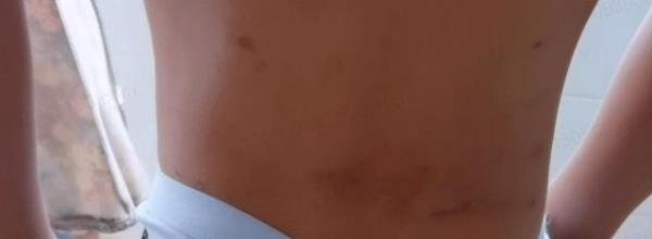 男童被锁家中5楼坠落奇迹生还 这是咋情况？