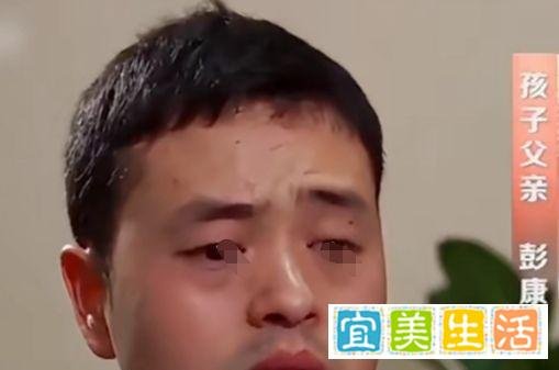 飞来横祸!五岁的双胞胎姐妹在家中被砍断脚筋,姐姐脸部被毁,行凶之人意想不到!