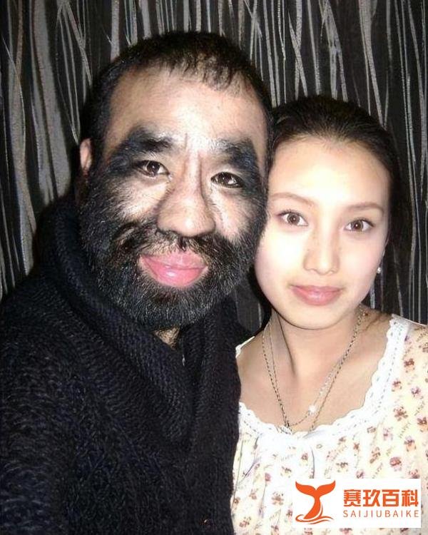 “中国第一毛孩”于震寰：为恋爱被逼脱毛，42岁才娶妻生子了！