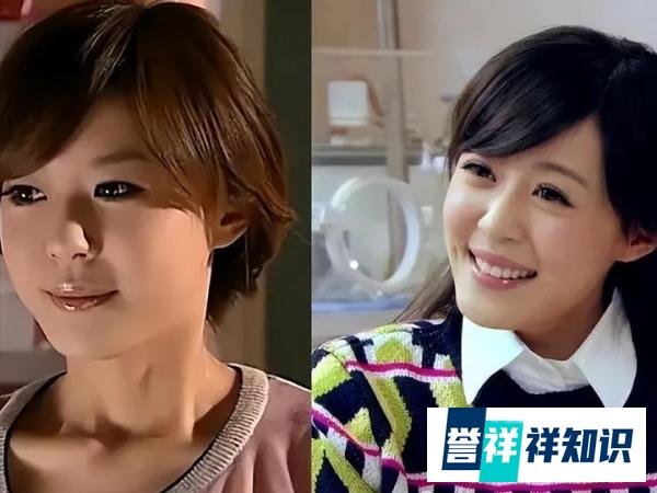 “整容变毁容”的6位女明星,整了之后,简直惨不忍睹