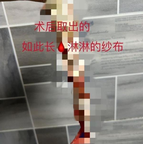 明星满舒克感染女友HPV！曾自称睡过73个女孩，抽加料烟自己验尿