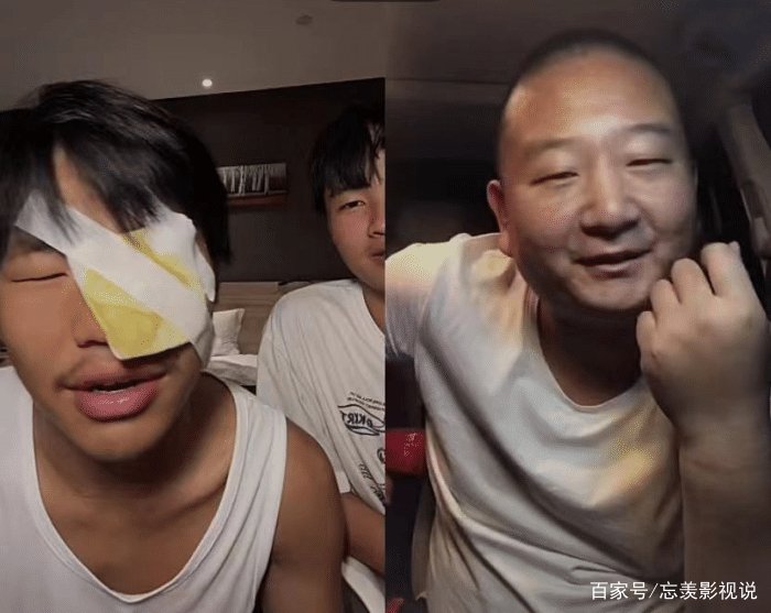 知名网红当街打架被警察带走,本人缠纱布受重伤,混乱场面曝光,你怎么看?