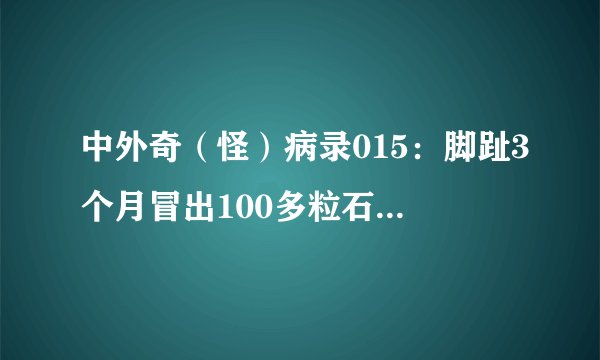 中外奇（怪）病录015：脚趾3个月冒出100多粒石珠 大马怪病少女脚吐水晶