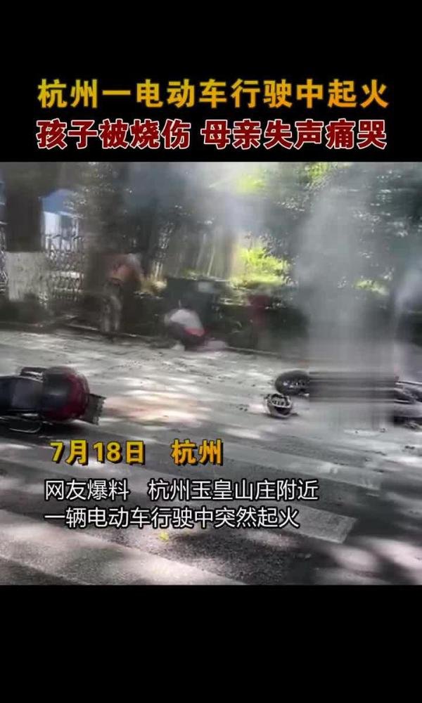 电瓶车行驶中爆燃 烧伤女孩病危