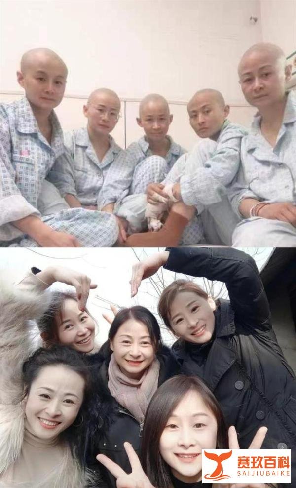 临沂一对年幼姐弟重度烧伤，妈妈和四名姨妈剃光头捐皮，姐姐已顺利完成手术