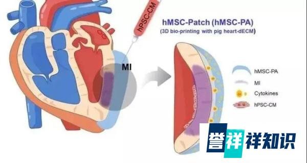 身家470亿的“板蓝根大王”离世，干细胞让心梗不再难治！