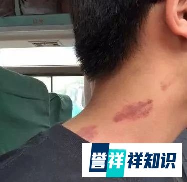 如何用安全的嘬力给女朋友种草莓？