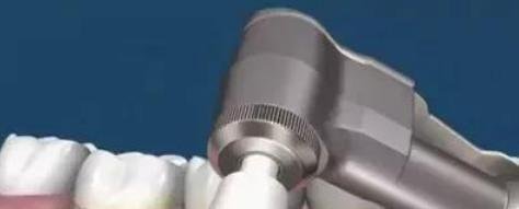 杭州洗牙一般要多少钱，洗牙需要多长时间？