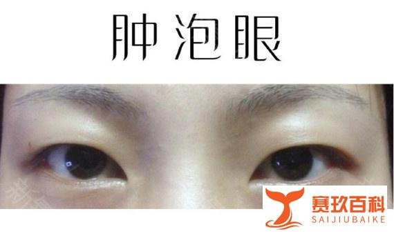 什么脸算是“大众脸”？其实大众脸也有这几个特征。