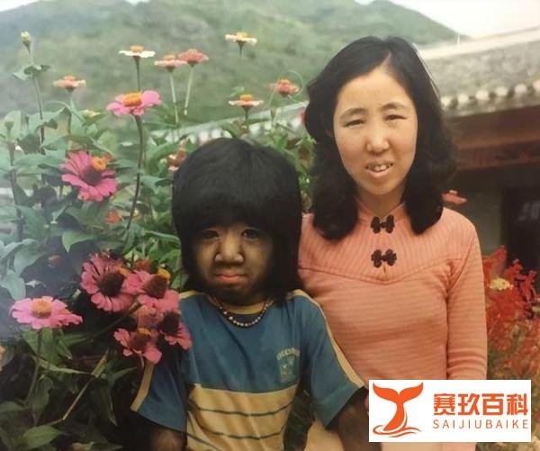 “中国第一毛孩”于震寰：为恋爱被逼脱毛，42岁才娶妻生子了！