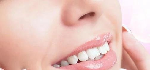 冷光牙齿美白需要多少钱一次？