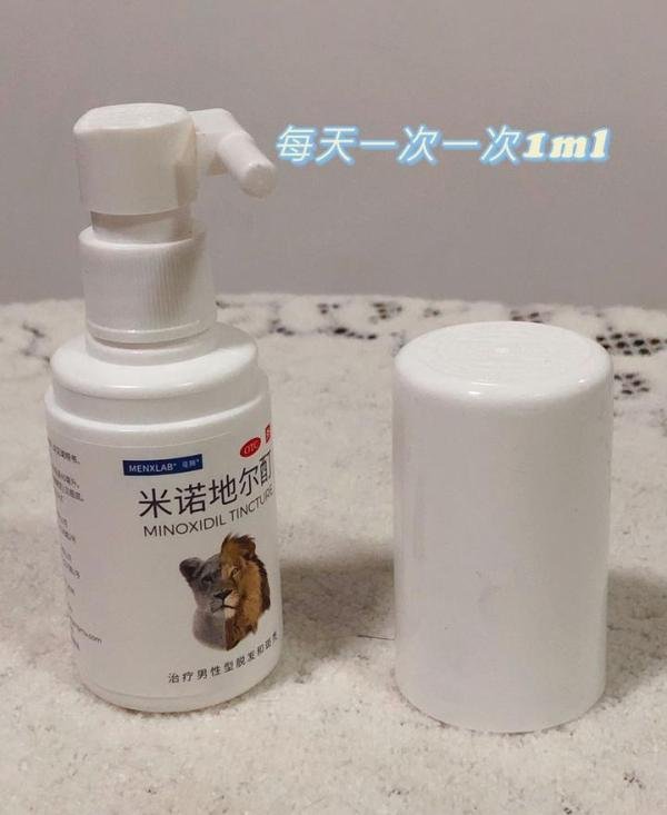 男性脱发严重，蔓狮米诺地尔和蔓迪米诺地尔哪个更好用？