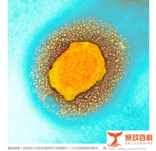 猴痘来袭，12国确诊80例，但猴子是被冤枉的