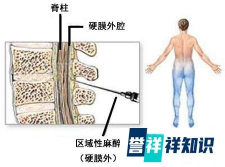 应采儿直播生产过程，看完你就知道该选顺产还是剖腹产...